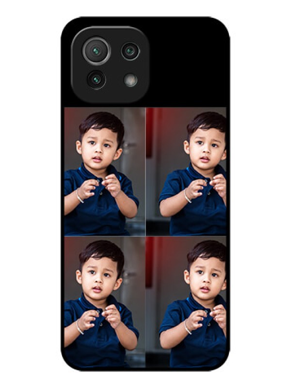 Custom Xiaomi Mi 11 Lite NE 5G Custom Metal Phone Case - 4 Image Holder Design