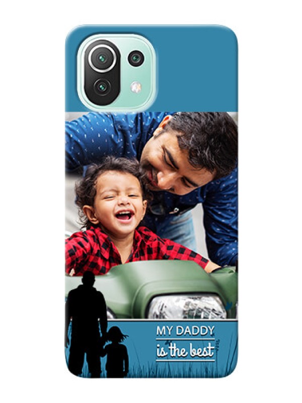 Custom Mi 11 Lite Personalized Mobile Covers: best dad design 