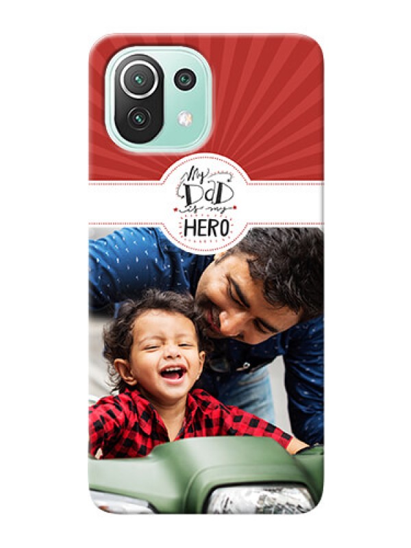 Custom Mi 11 Lite custom mobile phone cases: My Dad Hero Design
